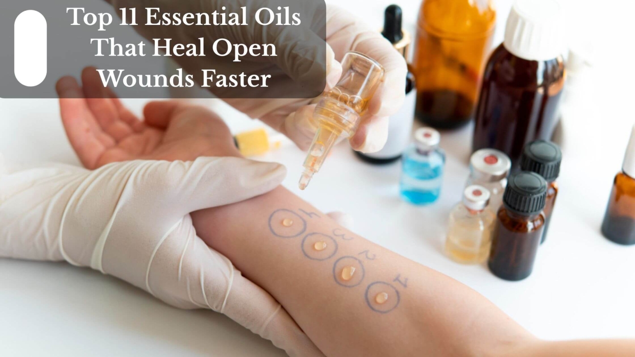 Top 11 Essential Oils That Heal Open Wounds Faster (1)
