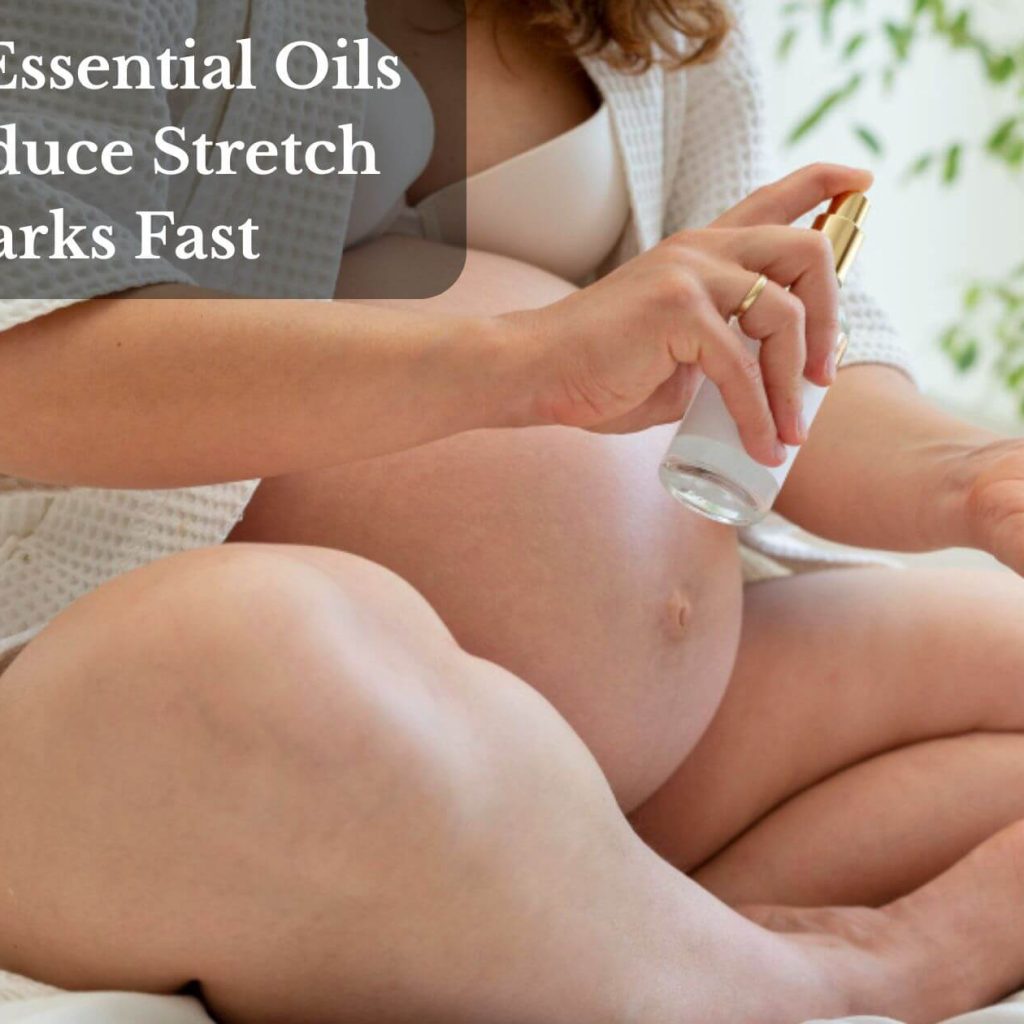 Top 9 Essential Oils To Reduce Stretch Marks Fast