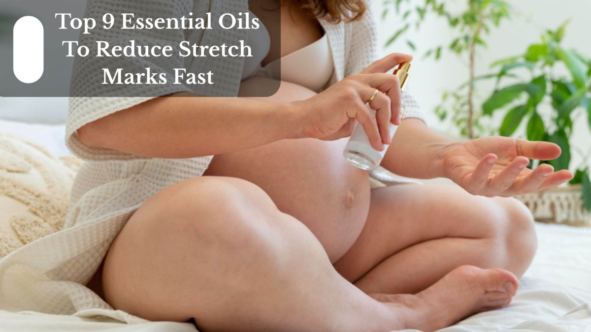 Top 9 Essential Oils To Reduce Stretch Marks Fast (1)