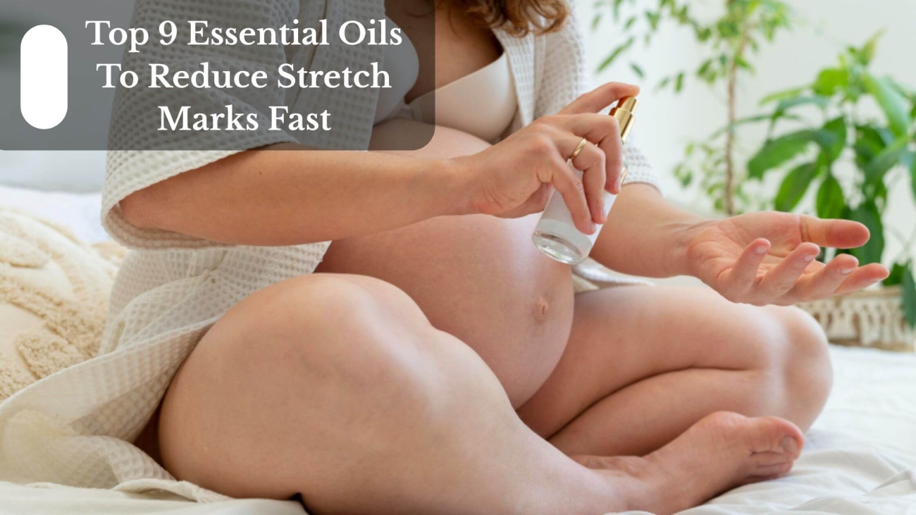 Top 9 Essential Oils To Reduce Stretch Marks Fast (1)