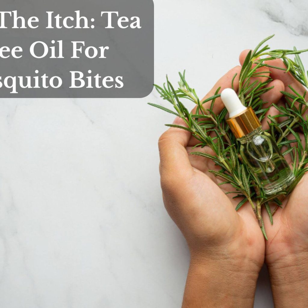 Stop The Itch: Tea Tree Oil For Mosquito Bites